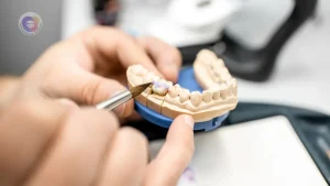 Curso Técnico em Prótese Dentária: Tudo o Que Você Precisa Saber